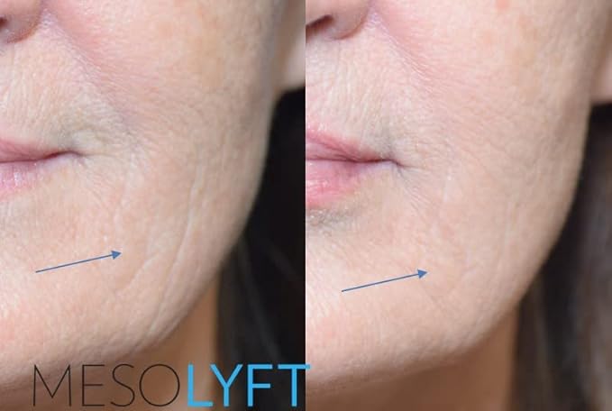 Anti-Aging Serum with Neck & Eyes Combo Skincare Face Serum Reduce Signs of Aging Roller for Face An Effective Treatment for Neck and Eyes
