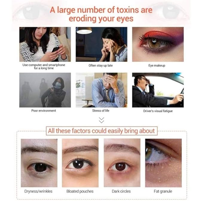 Under Eye Patches - 30 Pairs Collagen Eye Mask Eye Patches for Puffy Eyes and Dark Circles, Gel Under Eye Mask, Black