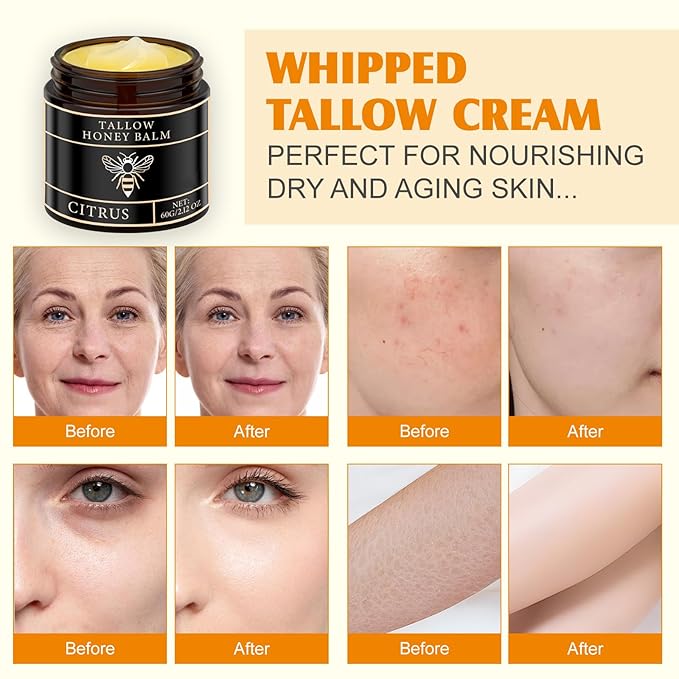 Tallow Honey Balm for Face Organic,Crema Cebo De Res Original,Handmade Tallow and Honey Balm for Face,Body,Sebo De Res Para La Cara,Based Supplies Tallow and Ho ney Bal m for Smooth Skin (2 Bottle)