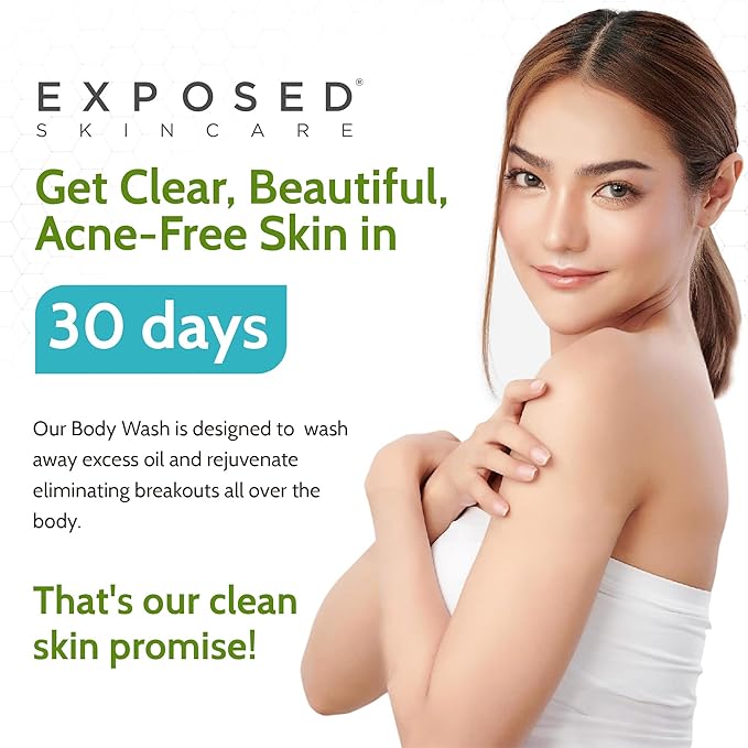 Exposed Skin Care Body Wash - Back and Body Acne Wash with Salicylic Acid and Tea Tree Oil – Exfoliating Bacne Treatment for Clearer, Healthier Skin – Body Cleanser for All Skin Types (12 fl oz)
