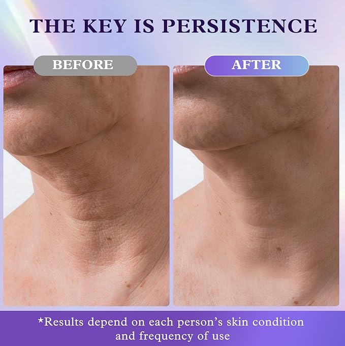 Retinol Neck & Face Wrinkle Cream for Women, Neck Cream for Tightening and Firming, Anti Aging Skin Care with Collagen & Hyaluronic Acid, Instant Face Lift Cream 1.7 Fl Oz