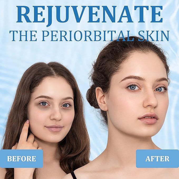 Under Eye Patches, Hyaluronic Acid Eye Mask, Collagen Eye Pads for Dark Circles, Eye Bags, Puffiness, Diminish Fine Lines and Wrinkles, Moisturize and Tighten Eye Skin for Men and Women