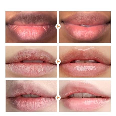 2PC Lip Balm Fade Dark Pigment Whitening Moisturizing Lip Hyaluronic Acid Exfoliating Dead Skin Lightening Lip Care (Pink)