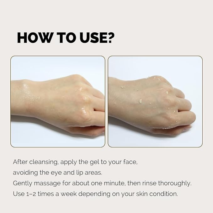 IASO Triple Action White Peeling Gel | Exfoliating Gel for Face, eep Pore Cleanse, Tone-Up Effect & Smoother Skin Texture, Korean Skin Care, 5.07 oz