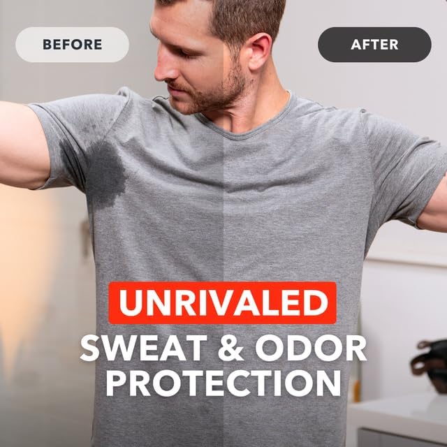 SweatBlock Antiperspirant Wipes - Maximum Clinical Strength - Treat Hyperhidrosis & Excessive Sweating for Men, Women, & Teens - up to 7 Days Protection Per Wipe - Dermatologist Tested - 20 Wipes