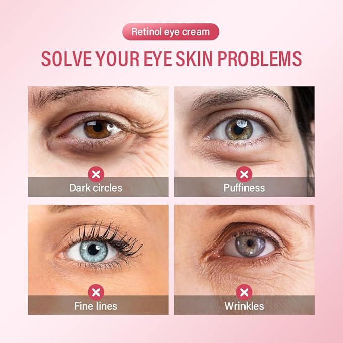 Retinol Eye Retinol Eye Cream for Dark Circles and Puffiness,Anti Aging Eye Cream with Collagen and Hyaluronic Acid,Smoothes Fine Lines,Firms and Lifts Eye Skin,Deeply Moisturizing