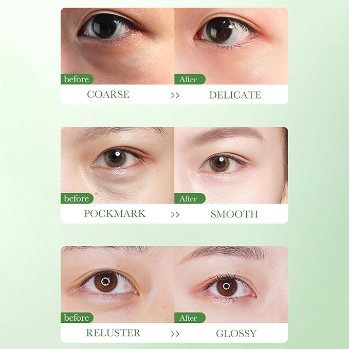 BIOAQUA Centella Asiatica Nourish Repair Eye Cream Soothing Oil Control Anti-Acne 20g / 0.7oz