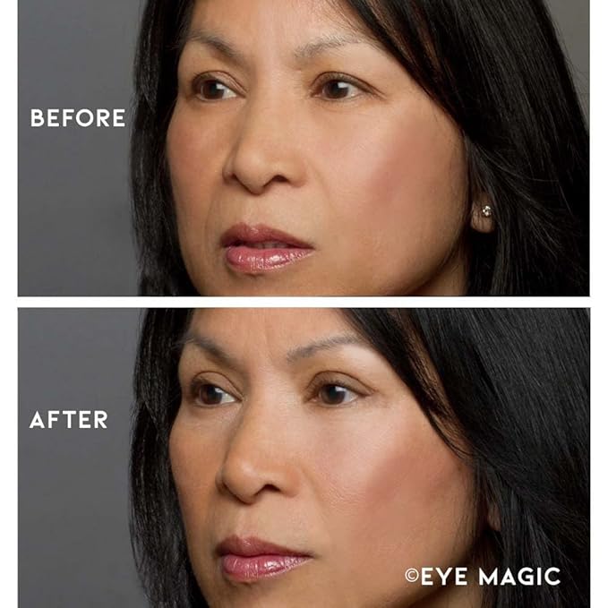 Eye Magic Premium Eyelid Lift (L/XL Kit + Gel) Made in America Lifts and Defines Droopy, Sagging or Hooded Eyes Safe For Daily Use