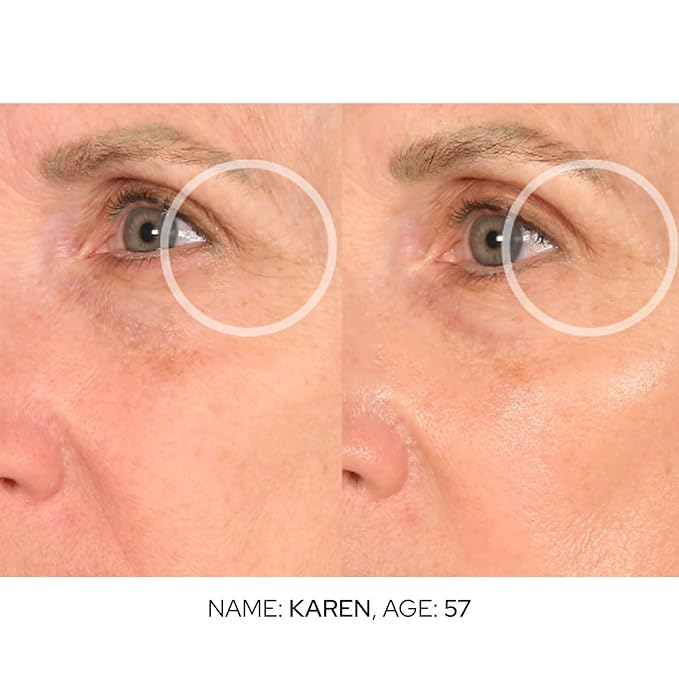 SiO Cooling Cryo Eye Cream - Anti-Aging, Hydrating Under Eye Concentrate Formulated For Targeting Dark Circles, Fine Line, Wrinkles, Puffiness & Bags
