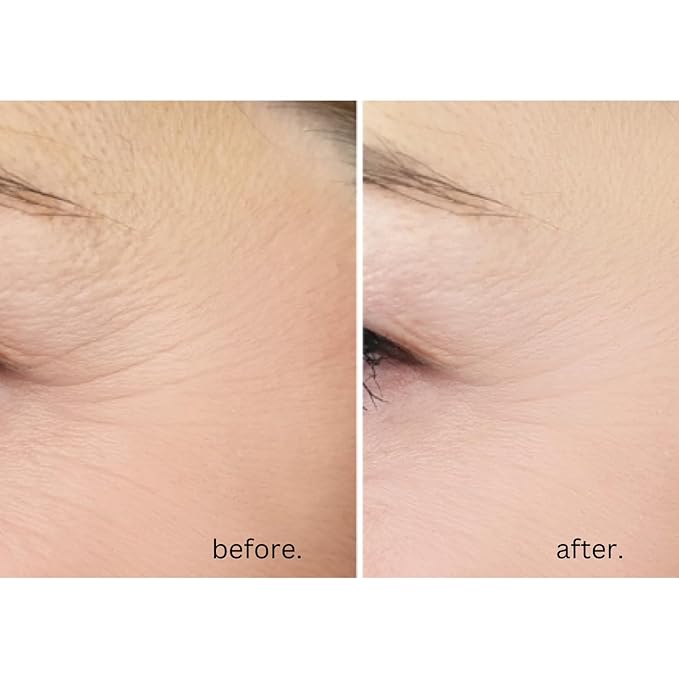 AWARD-WINNING Anti-Age Eye Cream - 5X MORE EFFECTIVE. With 20% Vitamin C & Hyaluronic Acid. Blast away dark circles, eye bags and puffiness - Reduce wrinkles and crow’s feet. Highest strength. 15ml