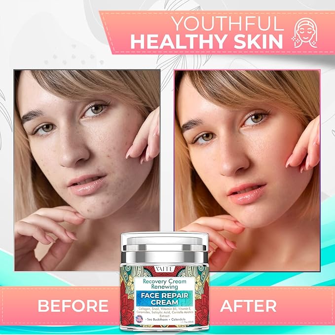 VAITE Face Moisturizer Remedy Skin Repair Cream with Snail, Salicylic Acid, Vitamin B5, Vitamin E, Collagen, and Ceramides for Men and Women Anti-aging Anti-wrinkle Made in USA Night and Day