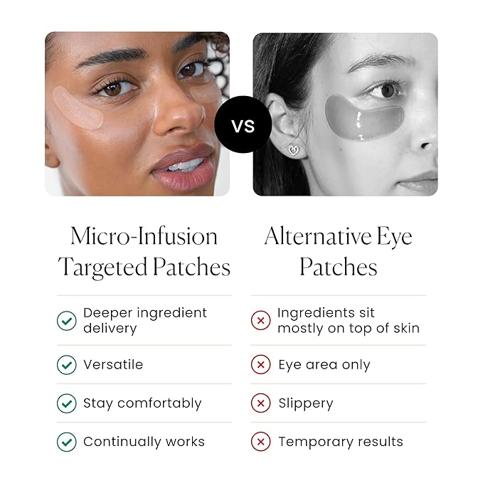 Qure Skincare MicroInfusion Targeted Patches - 8 Pairs of Targeted Under Eye Patches Formulated for Fine Lines & Wrinkles - Retinol, Caffeine, Niacinamide & Peptides - Dissolvable for Overnight Use