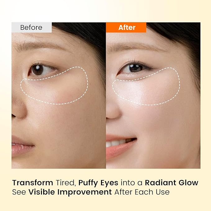 Caffeine Under Eye Patches: 30 Pairs Korean Hydrogel Eye Masks for Dark Circles Puffiness Relief with Niacinamide Hyaluronic Acid - Undereye Brightening Hydrating Anti-Wrinkle Treatment