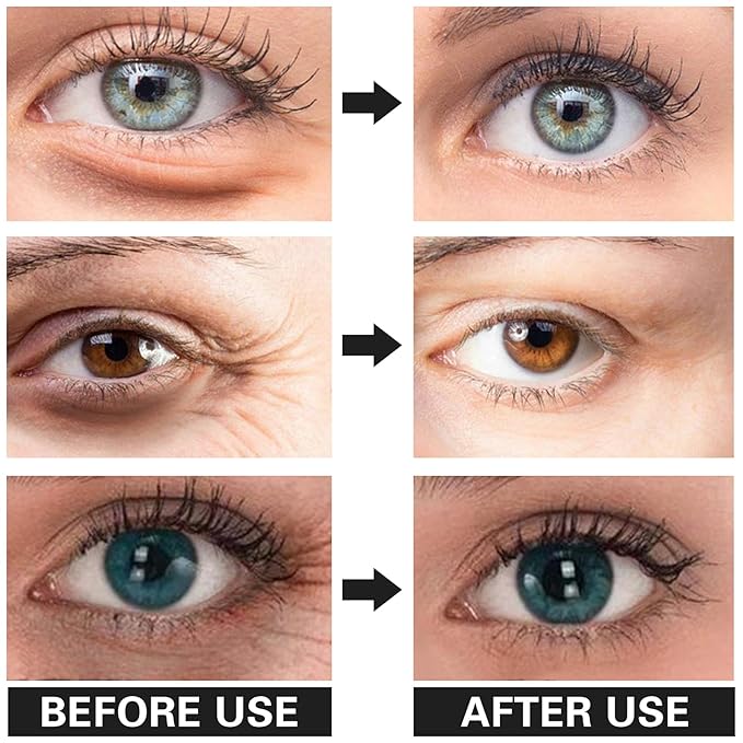 Eye Cream for Dark Circles Bags Eye Cream Eye Products Under Eye Bags Dark Circles