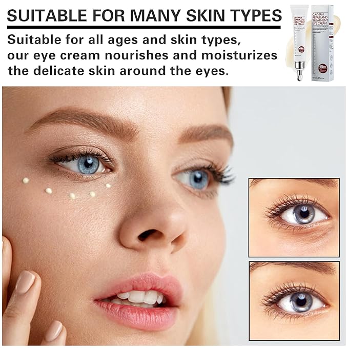 Eye Cream for Dark Circles Bags Eye Cream Eye Products Under Eye Bags Dark Circles