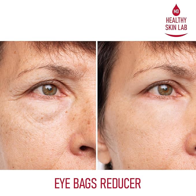 Reusable Under Eye Patches, Reduce Dark Circles, Puffy Eyes, Undereye Bags & Wrinkles - Medical-Grade Silicon Patches Reusable For Up To 3 Weeks