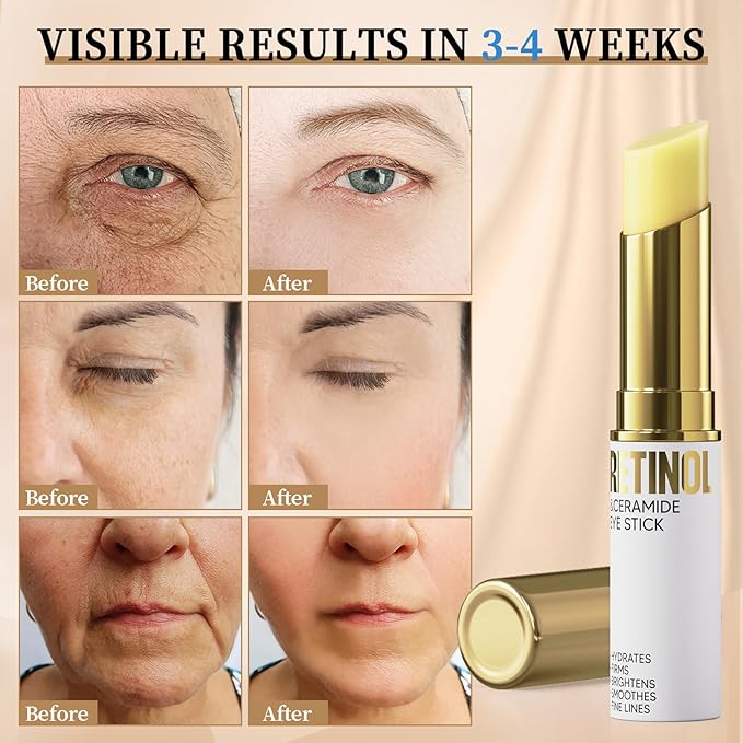 Retinol Eye Stick, Eye Cream for Dark Circles and Puffiness, Hydration and Brightening Eye Balm, Under Eye Cream Anti Aging Visible Results in 3-4 Weeks Reduces Fine Lines Bags