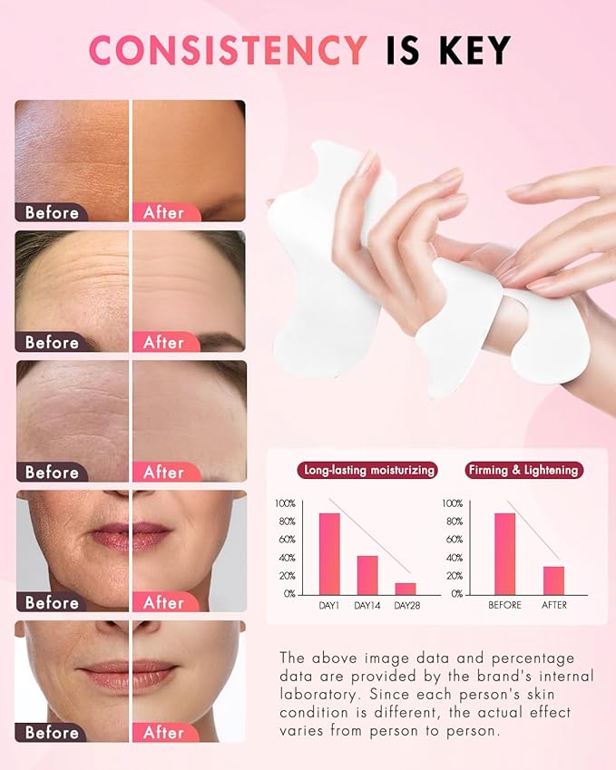 Forehead Wrinkle Patches & Smile Line Patches, Overnight Facial Wrinkle Treatment with Hyaluronic Acid, Aloe, Collagen & Vitamin E to Lift Smile Lines for Women 36pcs