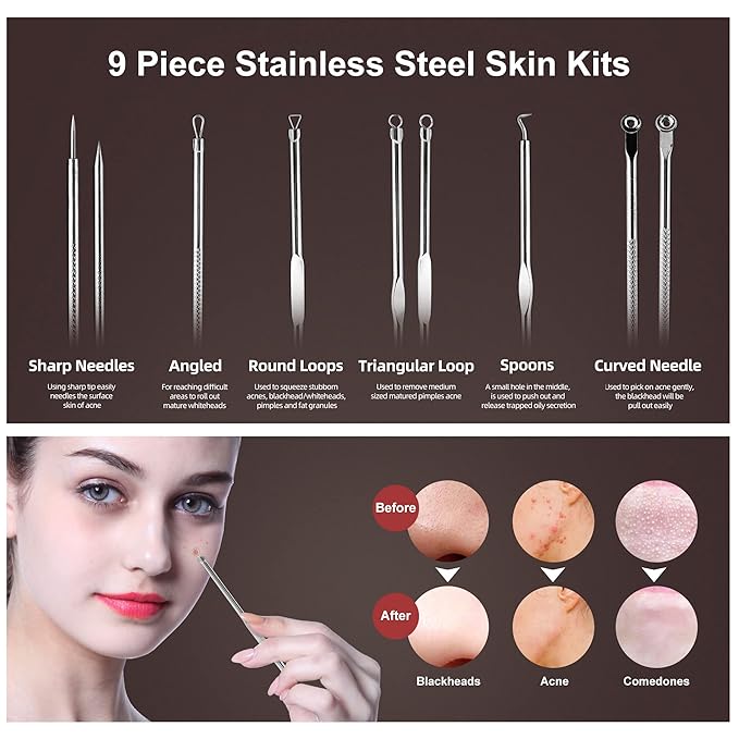 Newbealer Facial Steamer, Mini Aroma Face Steamer, Nano Ionic Hot Mist Facial Humidifier Atomizer, Home Sauna Spa Sprayer Moisturizing Cleansing Pores, 9 Pieces Acne Remover Kit (Pink-Gold, 160ml)