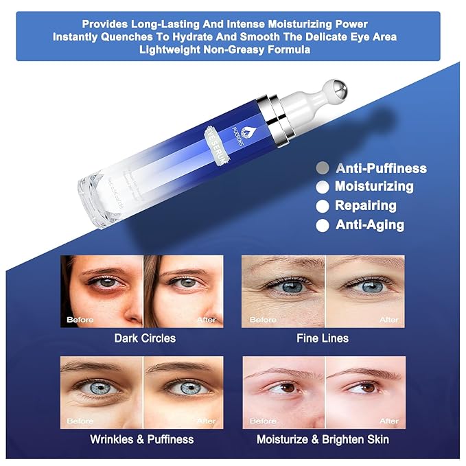 Under Eye Cream with 8% Caffeine & Retinol | Hyaluronic Acid, Niacinamide & Peptides | Eye Roller for Puffy Eyes, Dark Circles & Wrinkles | 2 fl. oz.…