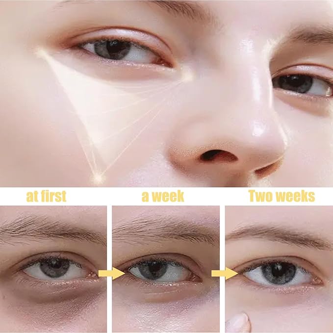 Under Eye Patches for Eye Patches for Puffy Eyes and Dark Circles