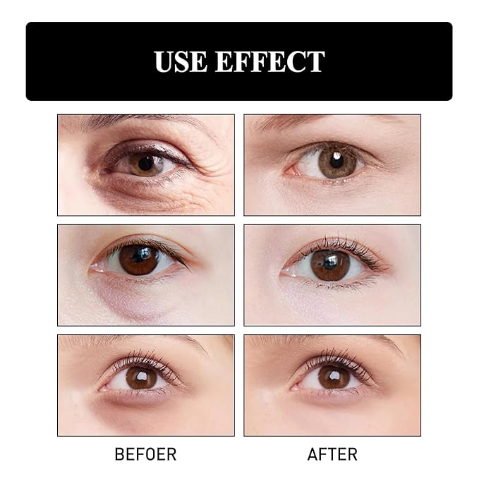 Retinol Snake Venom Peptide Eye Cream, Firming Eye Cream, Anti Ageing Eye Cream, Under Eye Cream For Puffiness and Bags Reduces Fine Lines
