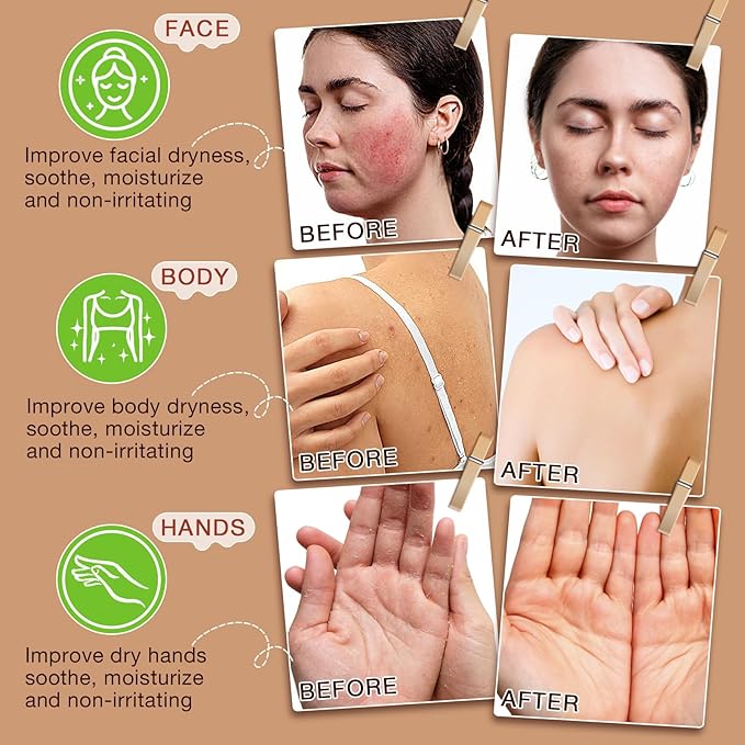 Beef Tallow for Skin,Tallow and Honey Balm,Beef Tallow for Face,Tallow Face Moisturizer,Natural Moisturizer Hydrates,Deeply Nourishes the Skin, Enhances Natural Radiance (1pcs)