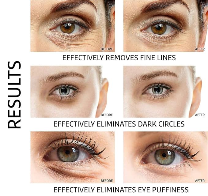 Under Eye Patches - 30 Pairs Collagen Eye Mask Eye Patches for Puffy Eyes and Dark Circles, Gel Under Eye Mask, Black