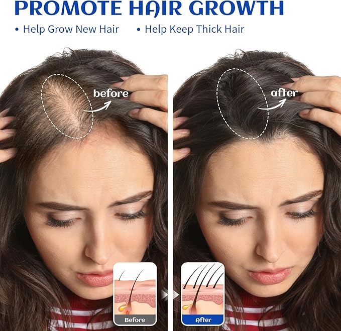 HIQILI 1000ML Rosemary Oil for Hair Growth, Add to Shampoo & Conditioner, 100% Pure Undiluted - 32 Fl Oz