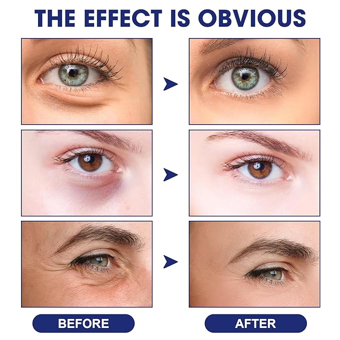 Anti Wrinkle Essence, Glozie Eye Serum, Glozie Instant Eye Lift Eye Cream, Anti Wrinkle Serum, Eye Cream For Wrinkles, Instant Anti-Aging Firm Eye Temporary Eye Tightener, Permanent Anti-Aging Cream