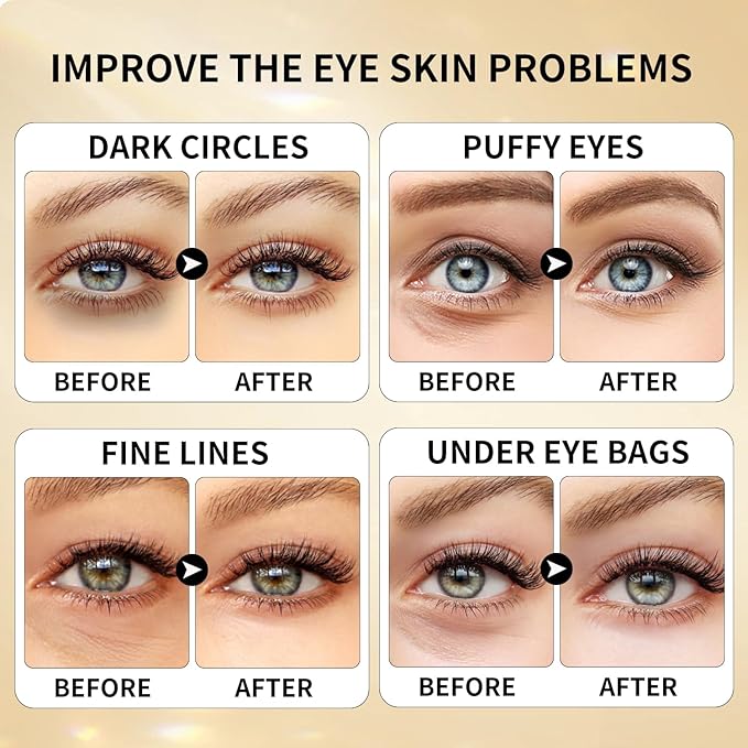ROUSE Under Eye Patches (20 Pairs), 24K Gold Collagen Anti-Wrinkle Eye Mask Golden Anti-Aging Smooth Eye Pads for Dark Circles Puffy Eyes Moisturizing Nourishing