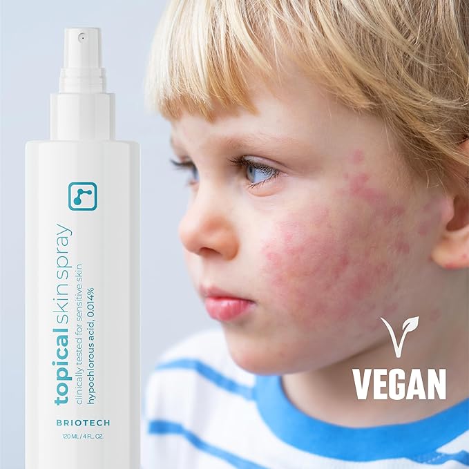 BRIOTECH Topical Skin Spray, Hypochlorous Acid Spray for Sensitive Skin, HOCl Facial Mist, Full Body Support Against Irritation, Calm Redness, Soothe Foot & Scalp, 4 oz