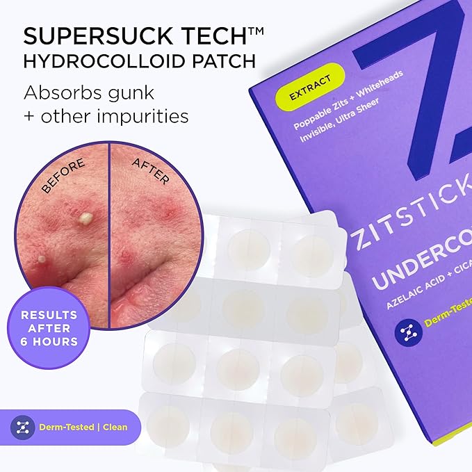 ZitSticka Invisible Pimple Patches for Face, Hydrocolloid Patches, Ultra-Thin Clear Azelaic Acid & CICA Blemish Patches, Pimple Stickers (UNDERCOVER 108 Count)