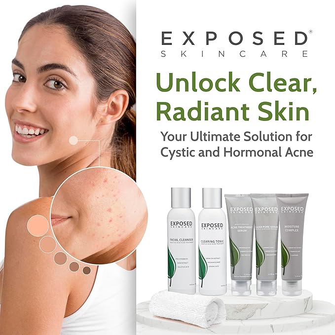 Exposed Skin Care Expanded Acne Treatment Kit - Includes Salicylic Acid Face Wash, Clearing Tonic, Treatment Serum with Benzoyl Peroxide, Clear Pore Serum, Moisture Complex - Made for All Skin Types