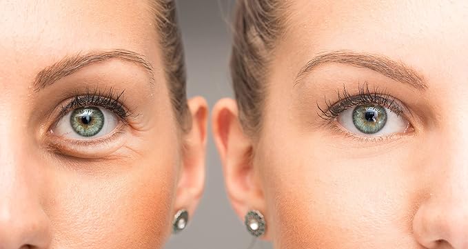 Anti Aging Eye Cream, Bright Eyes, Daily Wrinkle Cream for Firming, Dark Circles, Puffiness