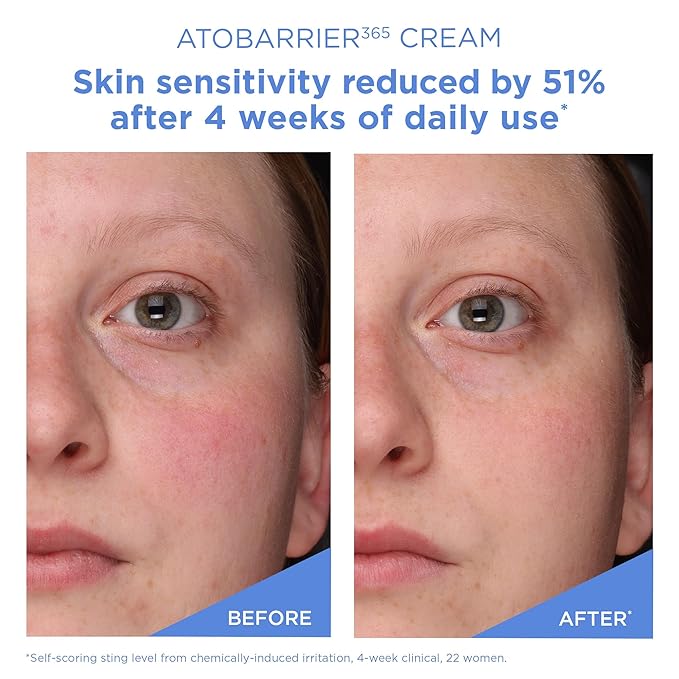 AESTURA ATOBARRIER365 Cream with Ceramides, Korean Face Moisturizer for Barrier Repair | 120H lasting Hydration, Ceramide Capsules, Dry & Sensitive Skin, Non-comedogenic, 80 mL / 2.70 fl.oz.