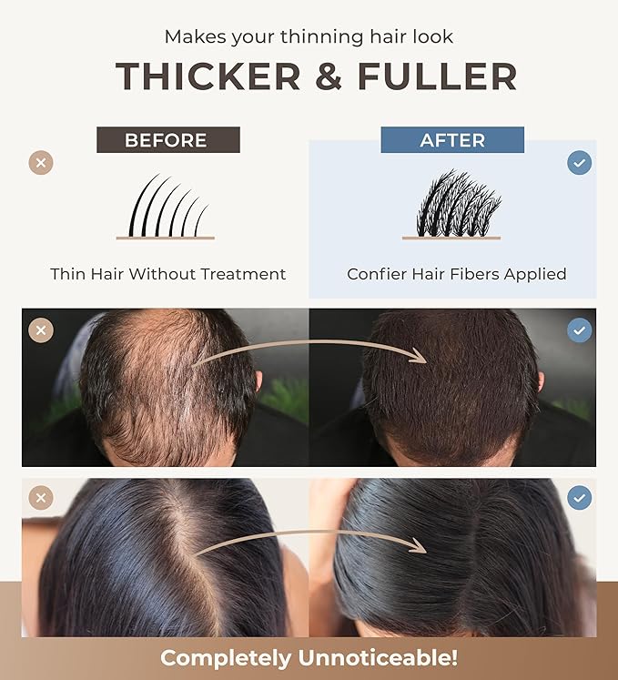 Keratin Hair Fibers for Men & Women - Fill In Fine or Thinning Hair, Instantly Thicker, Fuller Looking Hair (Black 30g)