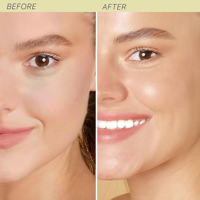 Hyaluronic Acid Moisturizer for Face - USA Made with Organic & Natural Ingredients, Hydrating Anti Aging Face Moisturizer for Dry Skin with Glycerin & Vitamin E, Unscented Anti Wrinkle Cream