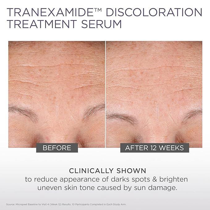 Glytone Micro-Peel TranEXamide™ Discoloration Correcting Serum | Dark Spot Remover with 3% Tranexamic Acid | Brightens Uneven Skin Tone for all Skin types | Fragrance Free, Paraben-Free - 1 fl oz