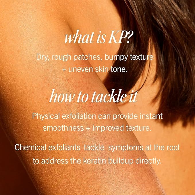 First Aid Beauty KP Bump Eraser Body Scrub Exfoliant for Keratosis Pilaris with 10% AHA – 8 oz + Bonus 1 oz Travel Size Tube