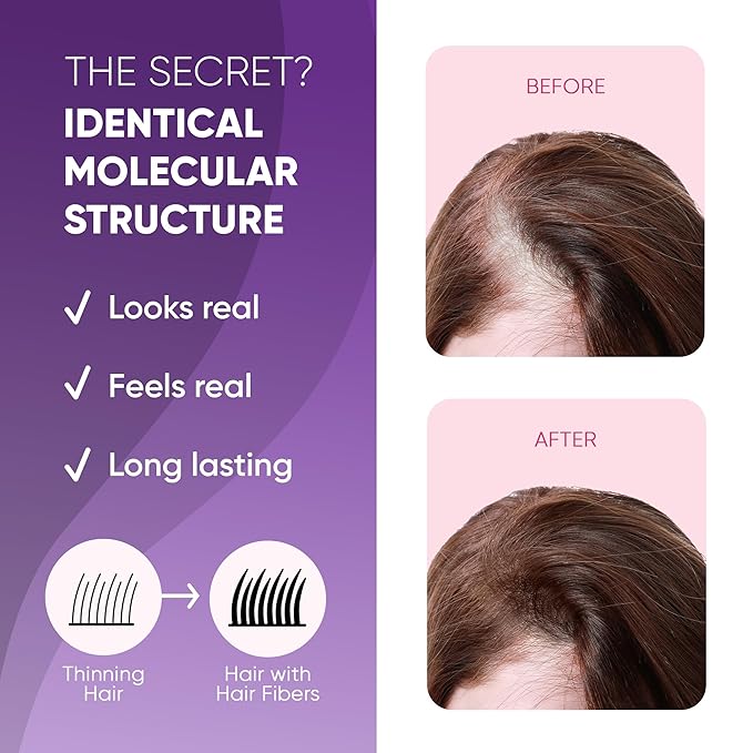 GBG Hair Fibers for Thinning Hair & Bald Spots (Light Brown) - 25g Bottle - Conceals Hair Loss - Instant Cover Up & Volume in 30 Seconds, Hair Powder for Women & Men - Cruelty Free