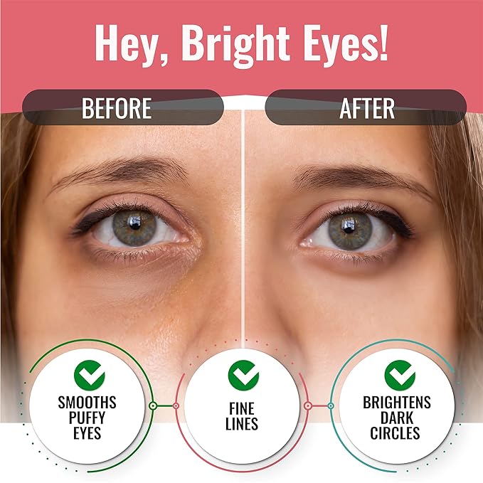 Under Eye Patches for Dark Circles and Puffiness (20 Pairs) - Korean Skin Care Caffeine Collagen Eye Patches for Puffy Eyes -Hydrogel Eye Patch - Under Eye Mask - Aloe Vera Rose Green Tea Gel Eye Pads