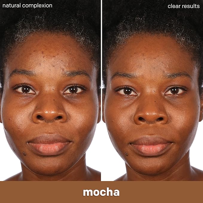 Almay Clear Complexion Acne Foundation Makeup with Salicylic Acid - Lightweight, Medium Coverage, Hypoallergenic, Fragrance-Free, for Sensitive Skin, 900 Mahogany, 1 fl oz.